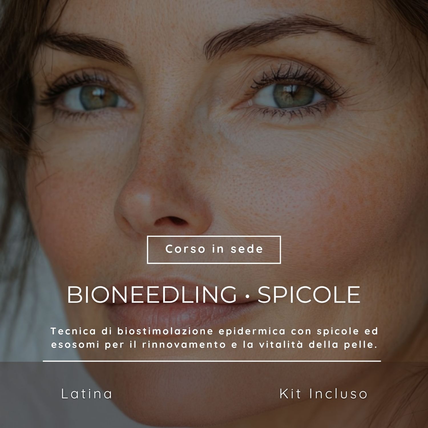 Bioneedling shop Corso di Bioneedling - immagine 1