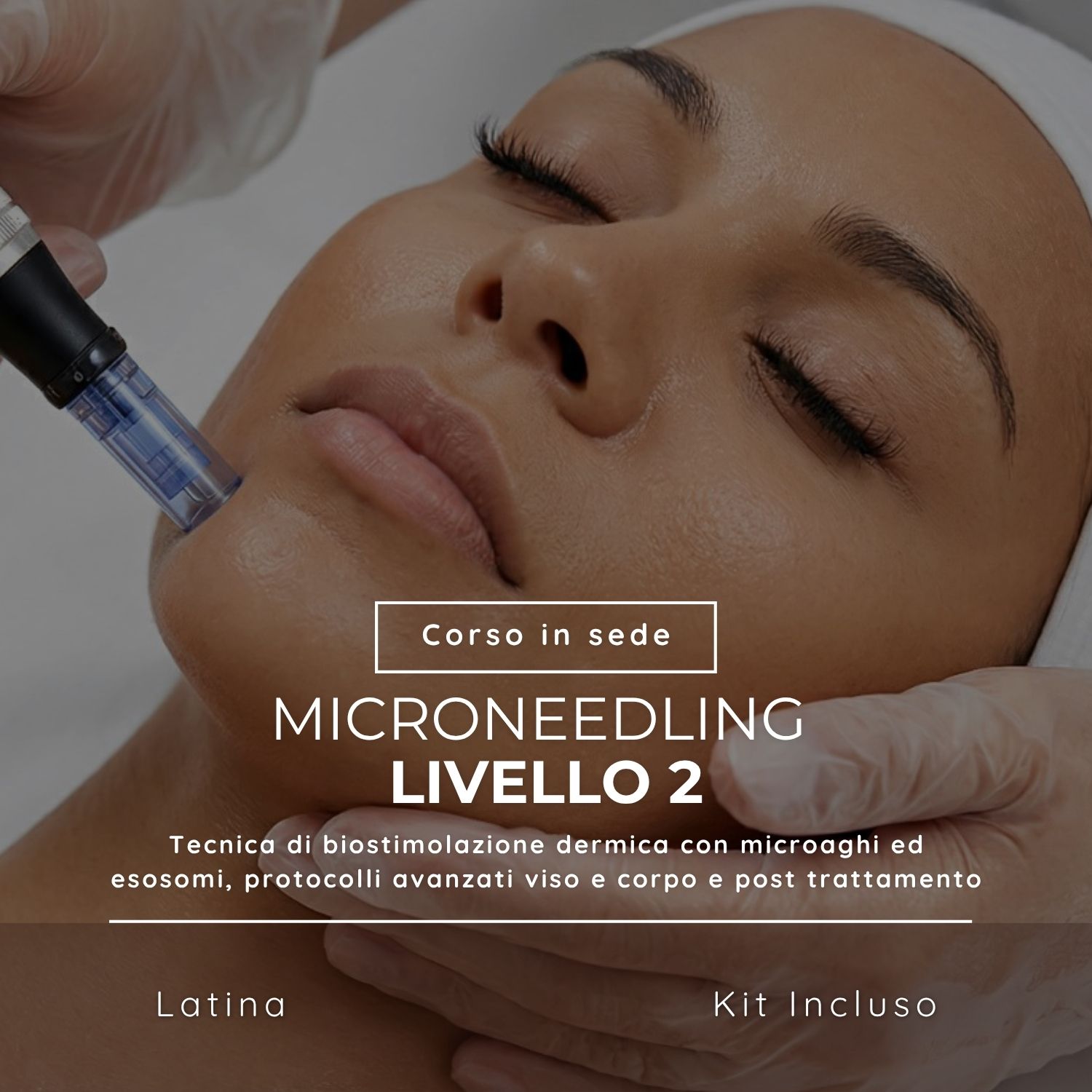 Microneedling Livello 2 Corso di Microneedling - Livello 2 - immagine 1