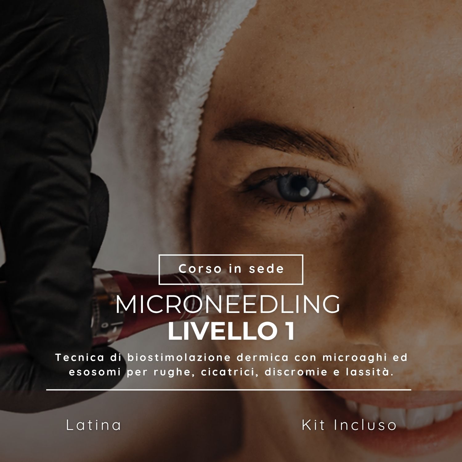 Microneedling livello 1 Corso di Microneedling - Livello 1 - immagine 1